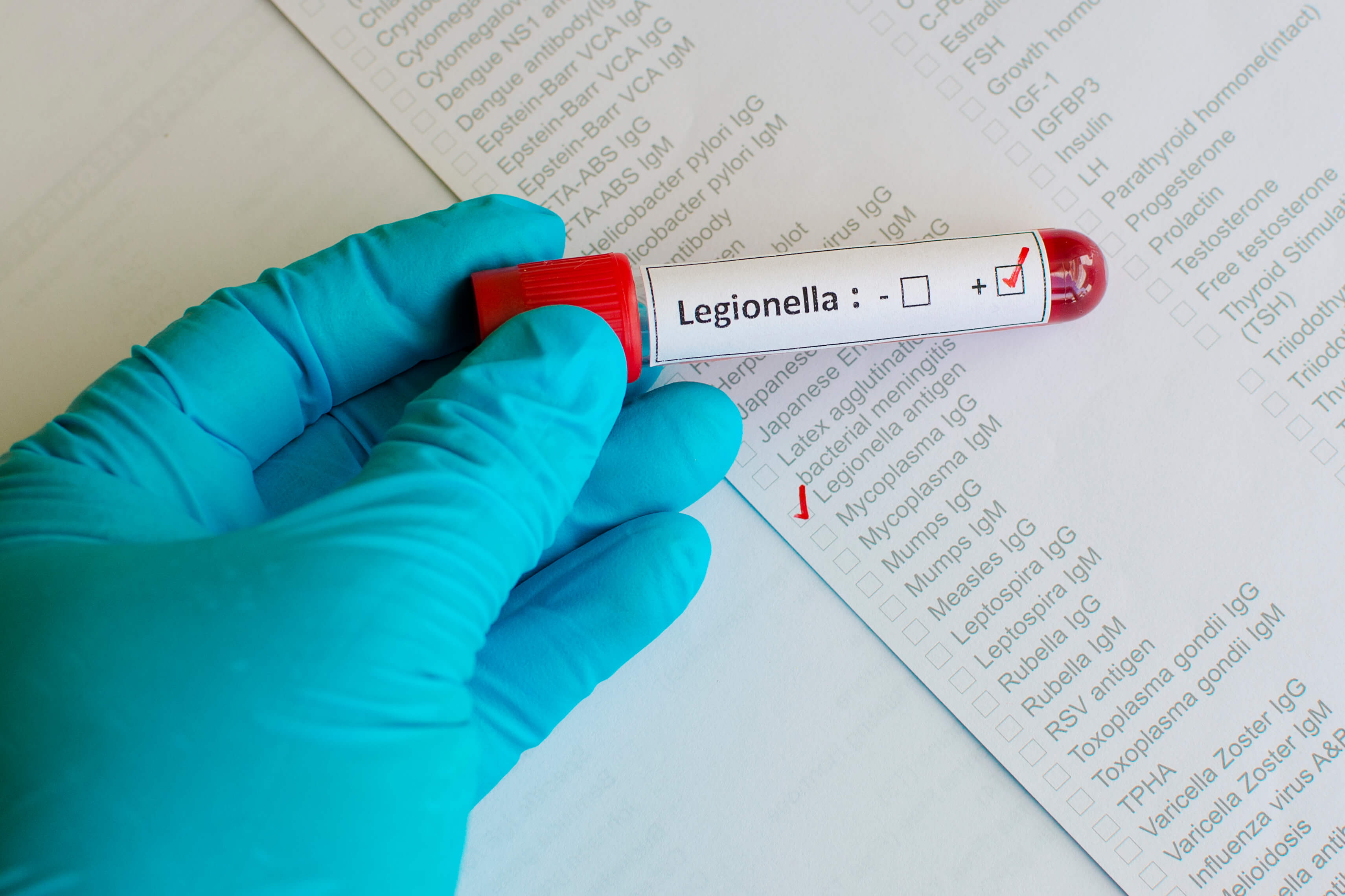 Muestra de análisis positivo para Legionella en un tubo de ensayo, realizada en el contexto de un programa de tratamiento de agua en instalaciones de riesgo